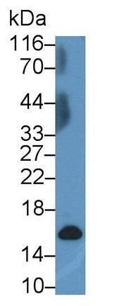Western Blot; Sample: Lane1: Porcine Esophagus lysate; Lane2: MCF7 cell lysate; Primary Ab: 0.2ug/ml Mouse Anti-Human CRABP2 Antibody; Second Ab: 0.2ug/mL HRP-Linked Caprine Anti-Mouse IgG Polyclonal Antibody