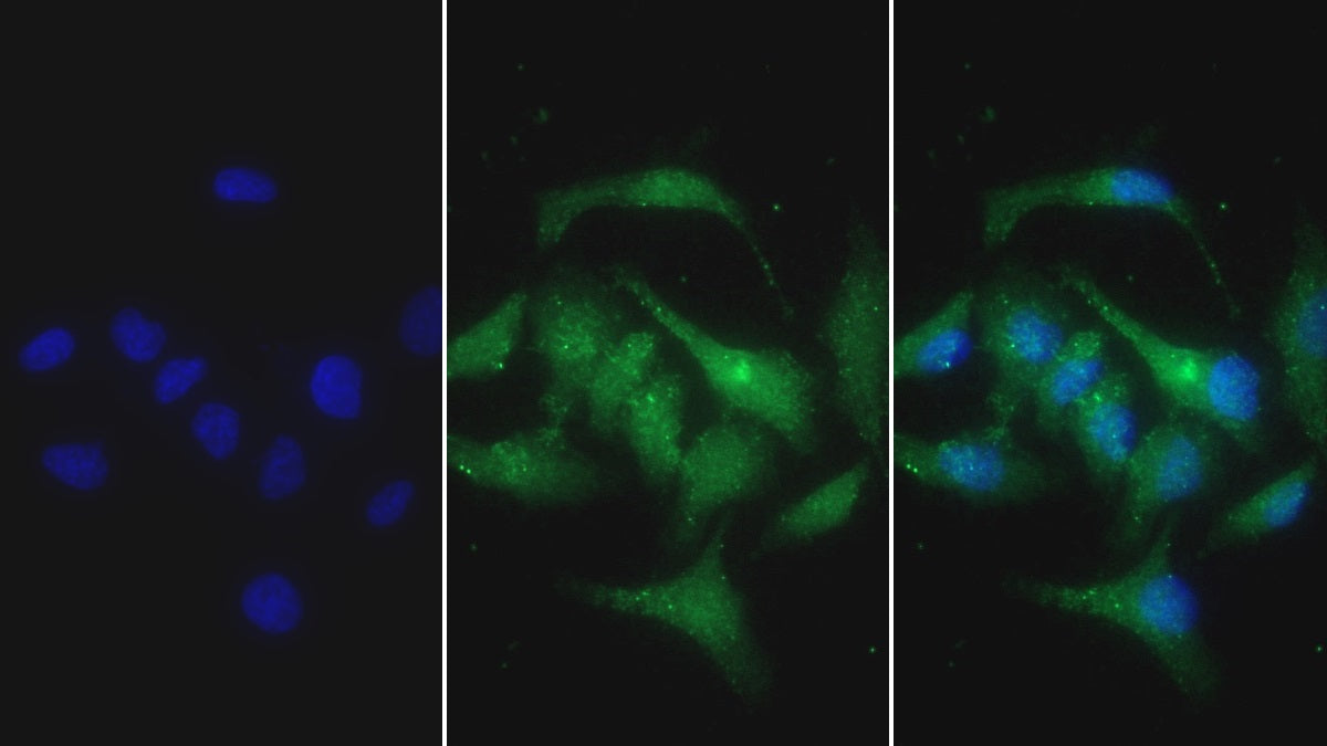 Western Blot; Sample: Human Leukocyte lysate Primary Ab: 2ug/ml Mouse Anti-Human S100A12 Antibody Second Ab: 0.2ug/mL HRP-Linked Caprine Anti-Mouse IgG Polyclonal Antibody