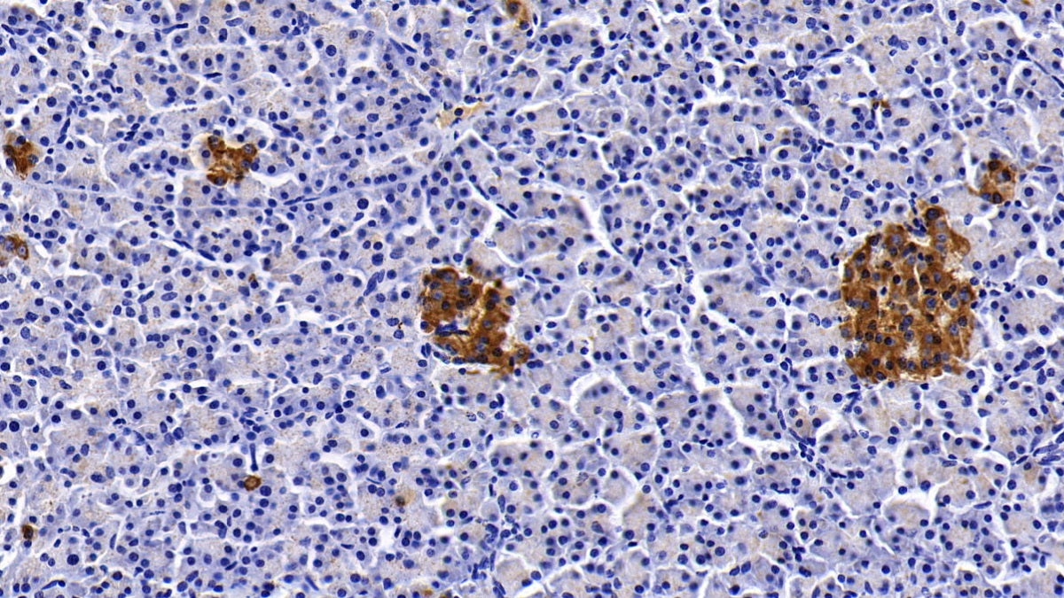 DAB staining on IHC-P; Sample: Porcine Liver Tissue; Primary Ab: 20ug/ml Mouse Anti-Porcine CLU Antibody; Second Ab: 2ug/mL HRP-Linked Caprine Anti-Mouse IgG Polyclonal Antibody