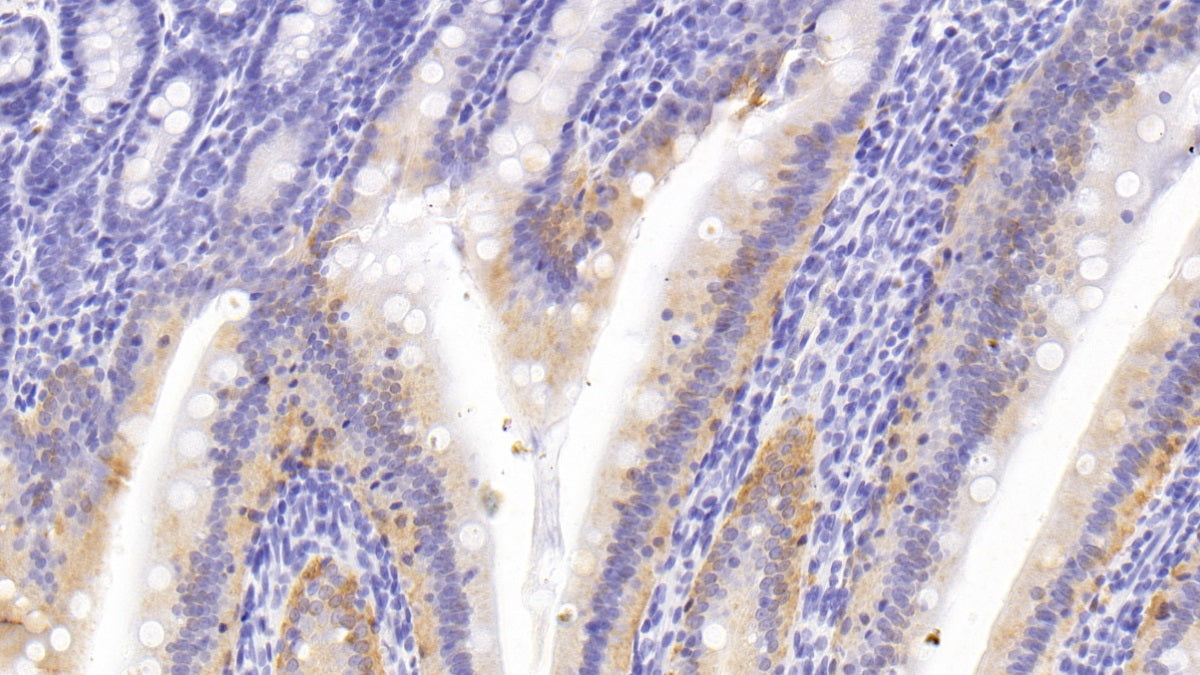 DAB staining on IHC-P; Sample: Rat Kidney Tissue; Primary Ab: 30ug/ml Mouse Anti-Rat CYPA Antibody; Second Ab: 2ug/mL HRP-Linked Caprine Anti-Mouse IgG Polyclonal Antibody