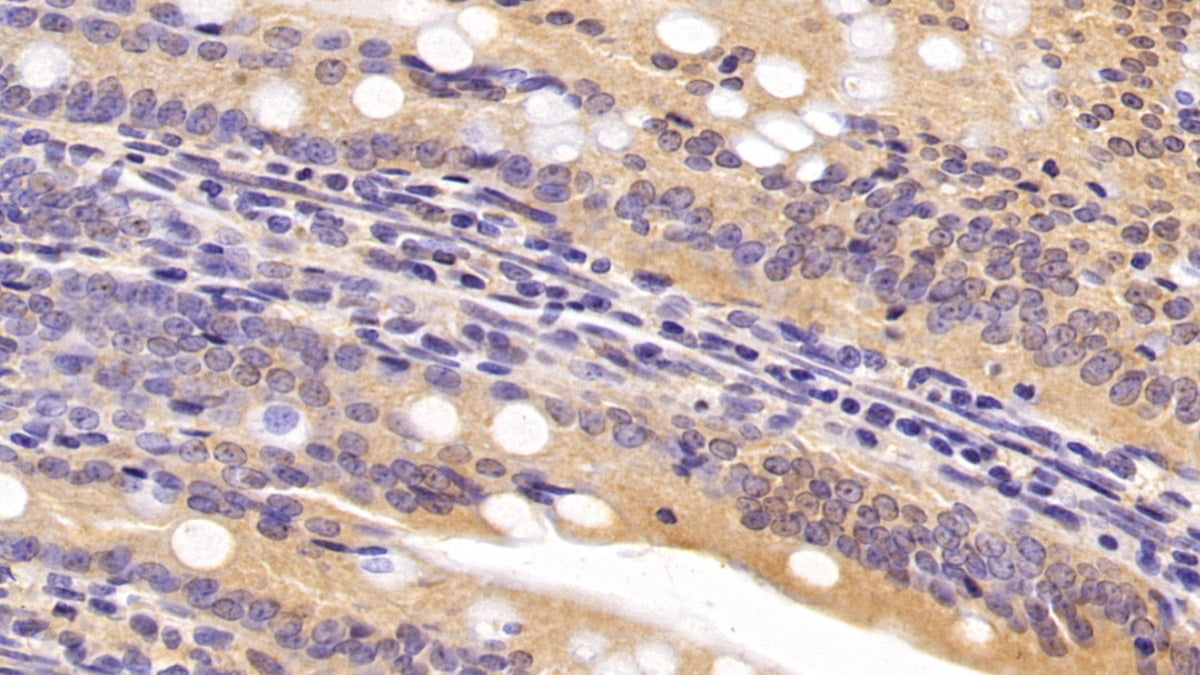 DAB staining on IHC-P; Sample: Rat Colon Tissue; Primary Ab: 20ug/ml Mouse Anti-Human CASP6 Antibody; Second Ab: 2ug/mL HRP-Linked Caprine Anti-Mouse IgG Polyclonal Antibody