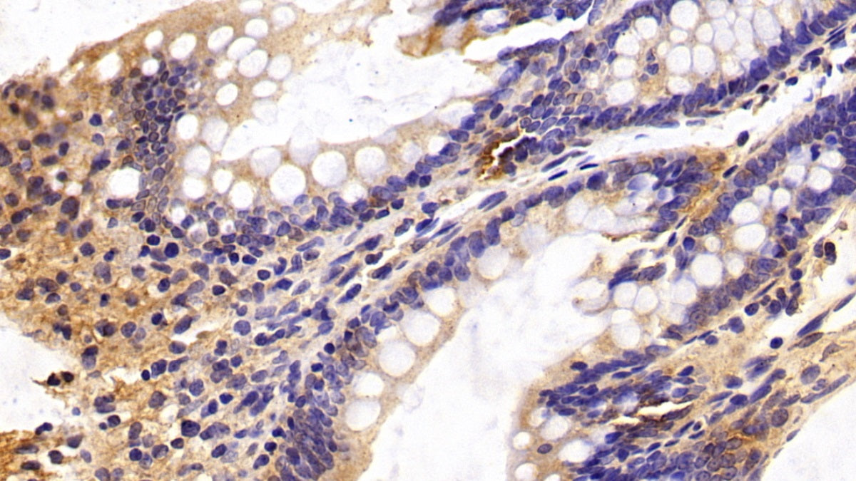 DAB staining on IHC-P; Sample: Rat Cerebrum Tissue; Primary Ab: 20ug/ml Mouse Anti-Human CASP6 Antibody; Second Ab: 2ug/mL HRP-Linked Caprine Anti-Mouse IgG Polyclonal Antibody