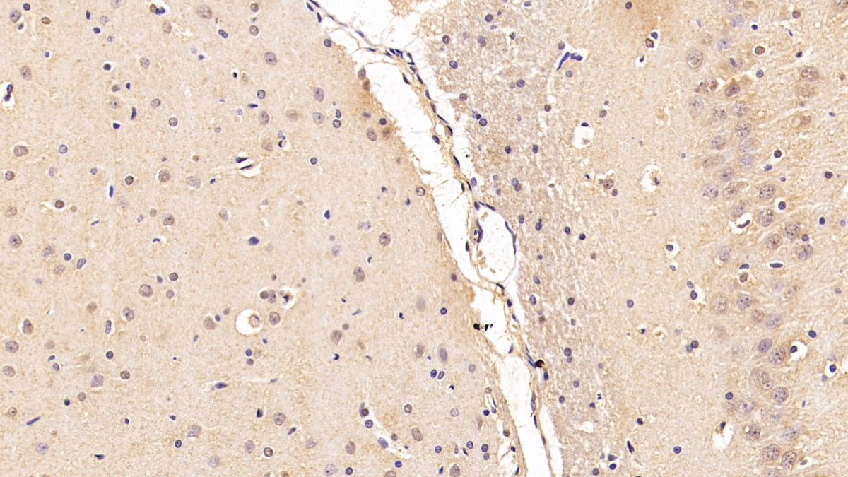 DAB staining on IHC-P; Sample: Rat Kidney Tissue; Primary Ab: 20ug/ml Mouse Anti-Human CASP6 Antibody; Second Ab: 2ug/mL HRP-Linked Caprine Anti-Mouse IgG Polyclonal Antibody