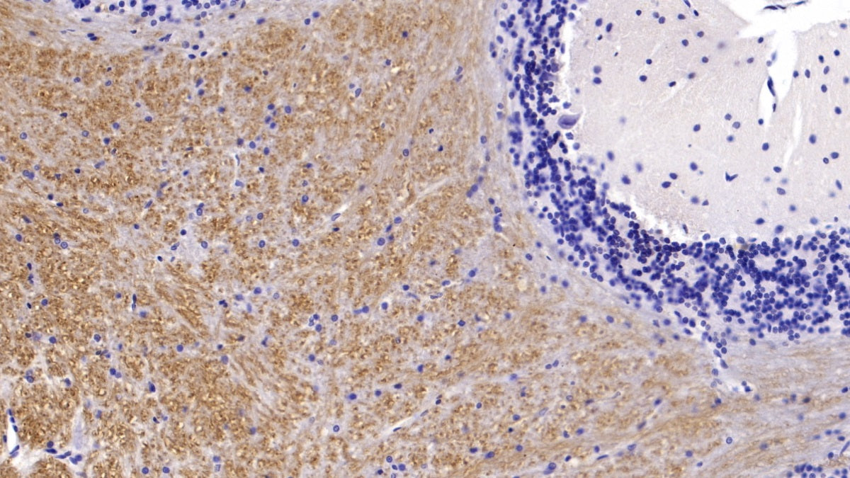 Microtubule Associated Protein 2 (MAP2) Monoclonal Antibody - image 2