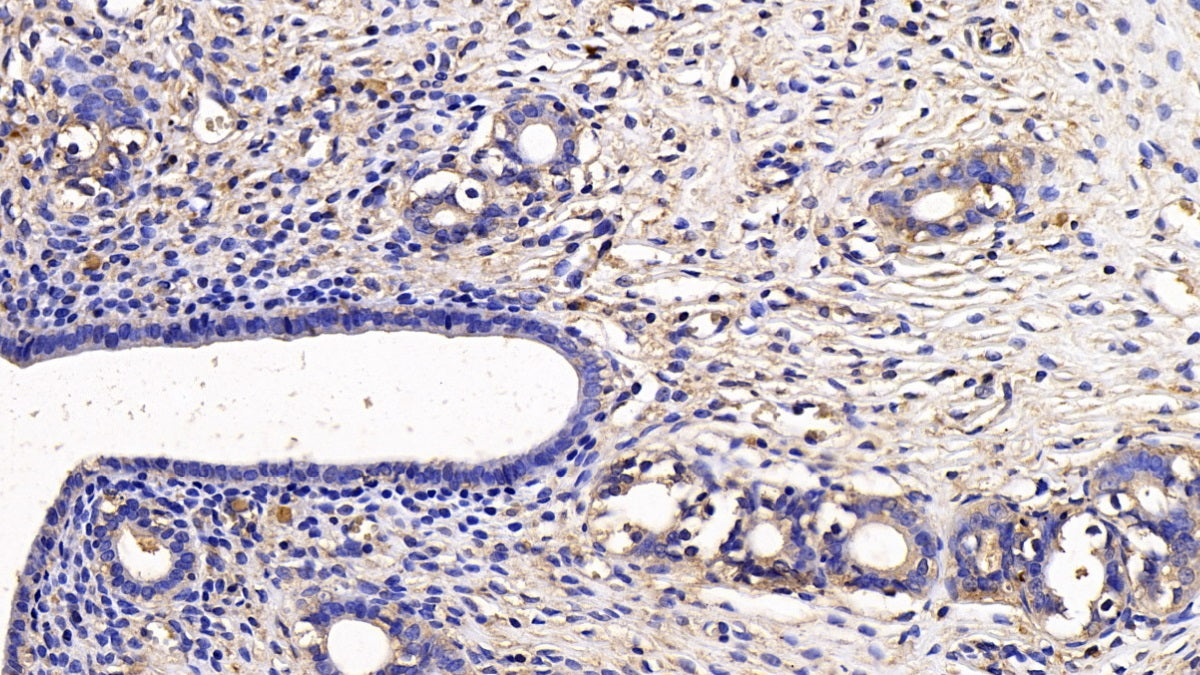 DAB staining on IHC-P; Sample: Rat Cardiac Muscle Tissue; Primary Ab: 30ug/ml Mouse Anti-Rat SFRP1 Antibody; Second Ab: 2ug/mL HRP-Linked Caprine Anti-Mouse IgG Polyclonal Antibody