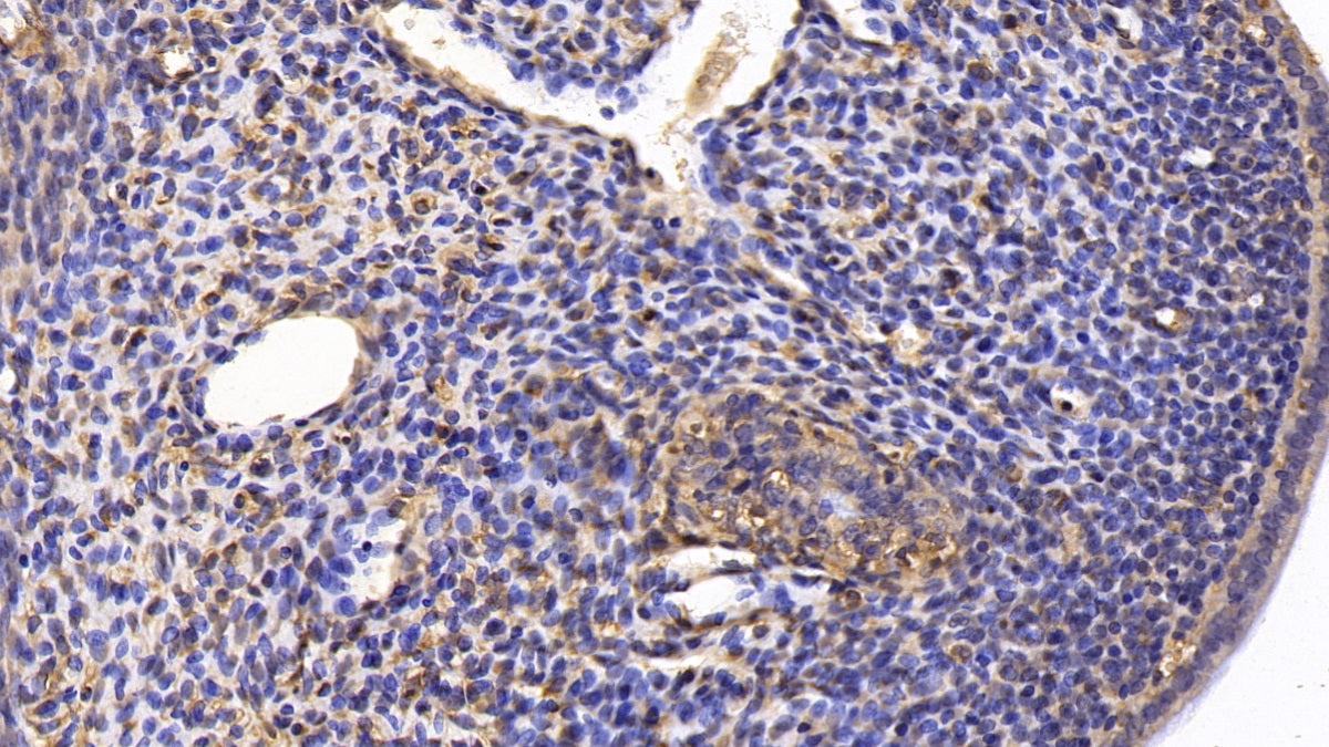 DAB staining on IHC-P; Sample: Rat Cardiac Muscle Tissue; Primary Ab: 30ug/ml Mouse Anti-Rat SFRP1 Antibody; Second Ab: 2ug/mL HRP-Linked Caprine Anti-Mouse IgG Polyclonal Antibody