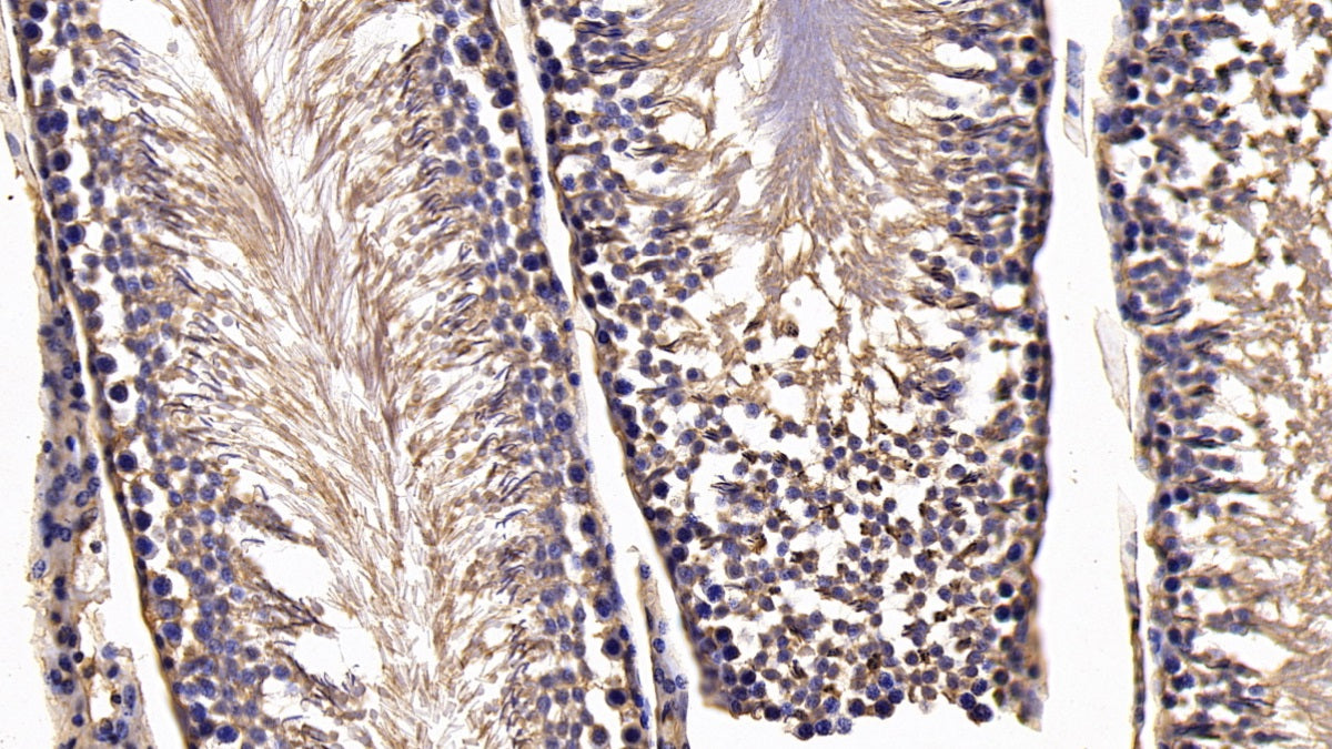 DAB staining on IHC-P; Sample: Rat Liver Tissue; Primary Ab: 30ug/ml Mouse Anti-Rat SFRP1 Antibody; Second Ab: 2ug/mL HRP-Linked Caprine Anti-Mouse IgG Polyclonal Antibody