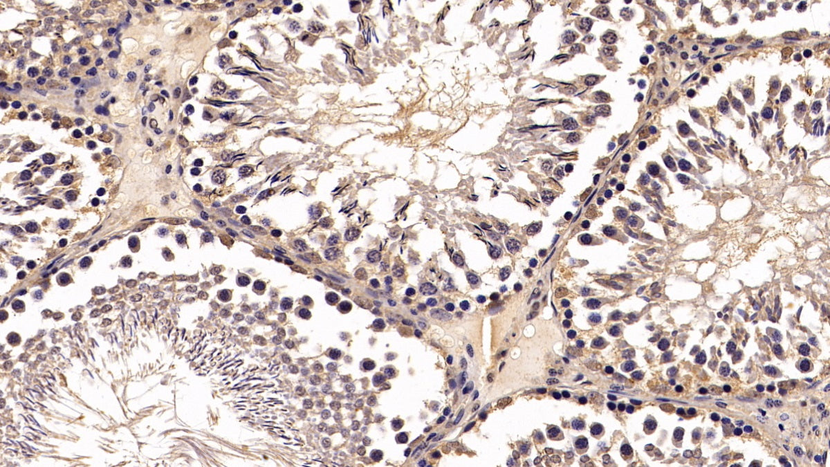 Von Hippel Lindau Tumor Suppressor (vHL) Monoclonal Antibody - image 3