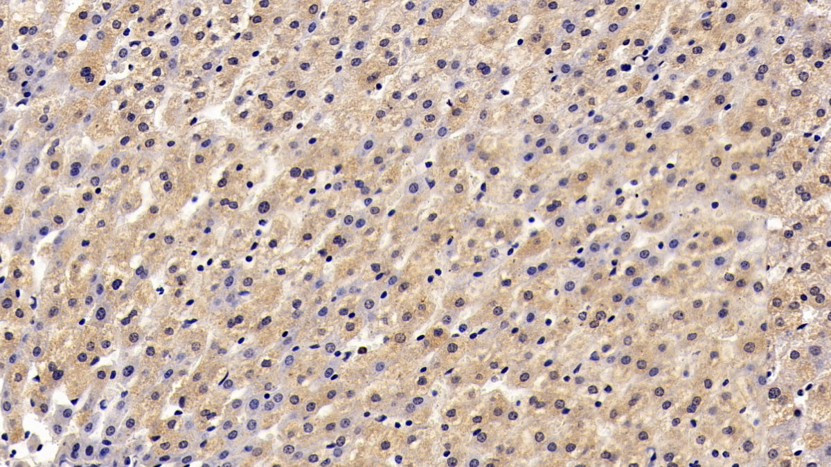 DAB staining on IHC-P; Sample: Human Stomach Tissue; Primary Ab: 30ug/ml Mouse Anti-Human ANTXR2 Antibody; Second Ab: 2ug/mL HRP-Linked Caprine Anti-Mouse IgG Polyclonal Antibody