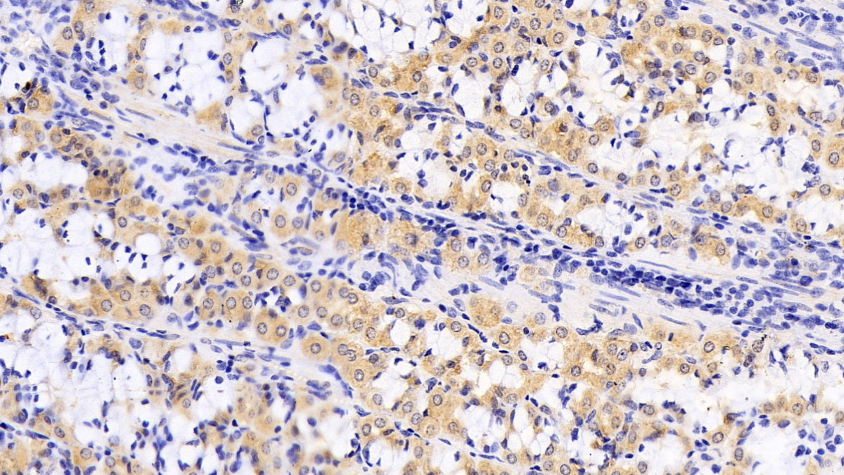 DAB staining on IHC-P; Sample: Human Kidney Tissue; Primary Ab: 30ug/ml Mouse Anti-Human ANTXR2 Antibody; Second Ab: 2ug/mL HRP-Linked Caprine Anti-Mouse IgG Polyclonal Antibody