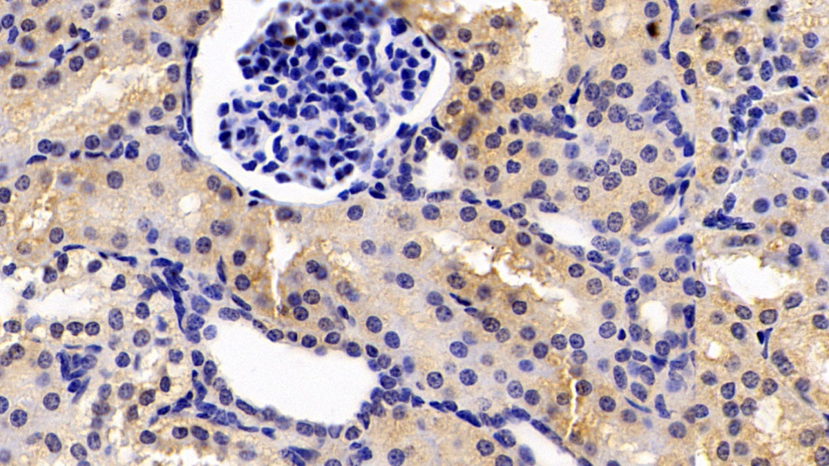 Anthrax Toxin Receptor 2 (ANTXR2) Monoclonal Antibody - image 4