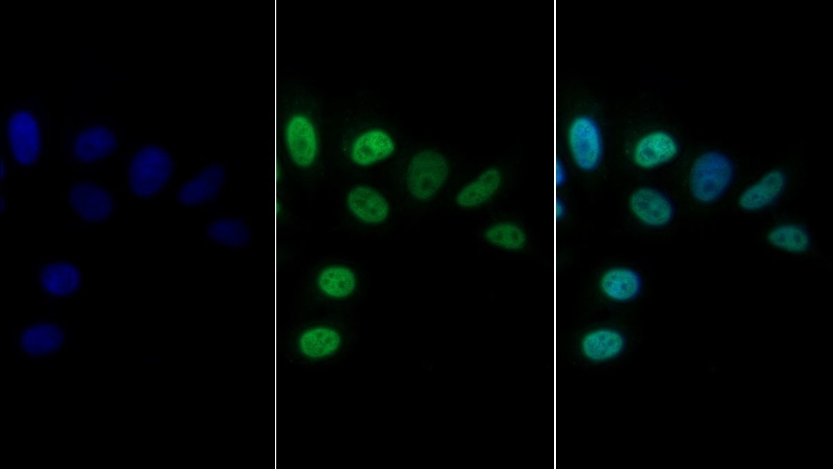 CCAAT/Enhancer Binding Protein Alpha (CEBPa) Monoclonal Antibody - image 2