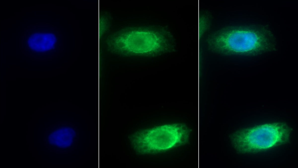 Interleukin 8 Receptor Beta (IL8Rb) Monoclonal Antibody - image 2