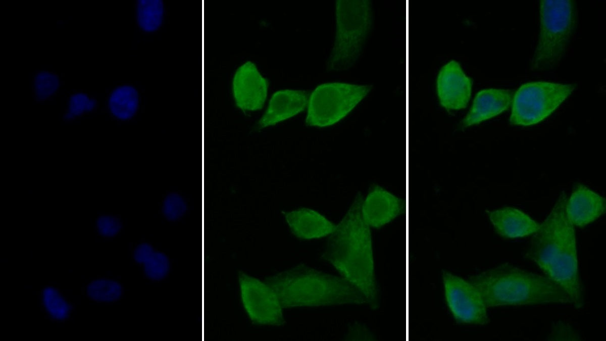Interleukin 2 Receptor Alpha (IL2Ra) Monoclonal Antibody - image 2