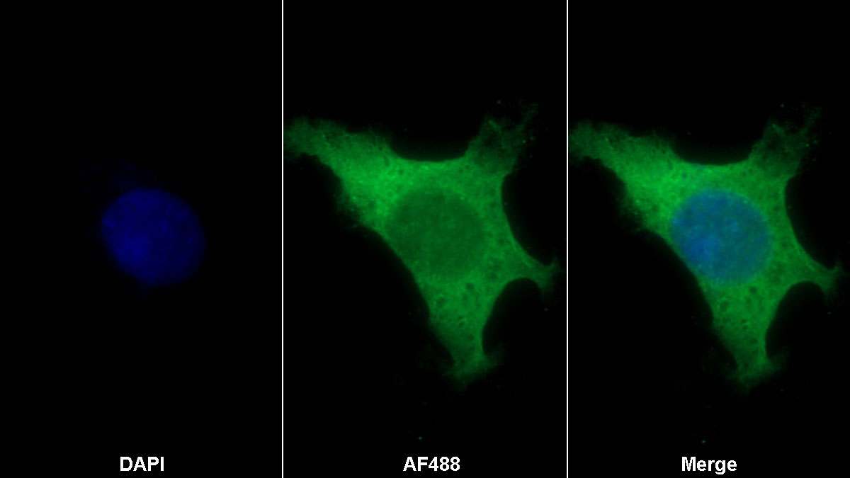 S100 Calcium Binding Protein B (S100B) Monoclonal Antibody - image 2
