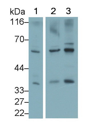 Dickkopf Related Protein 1 (DKK1) Monoclonal Antibody - image 2