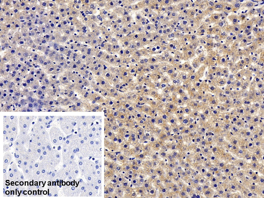 C Reactive Protein (CRP) Monoclonal Antibody - image 2
