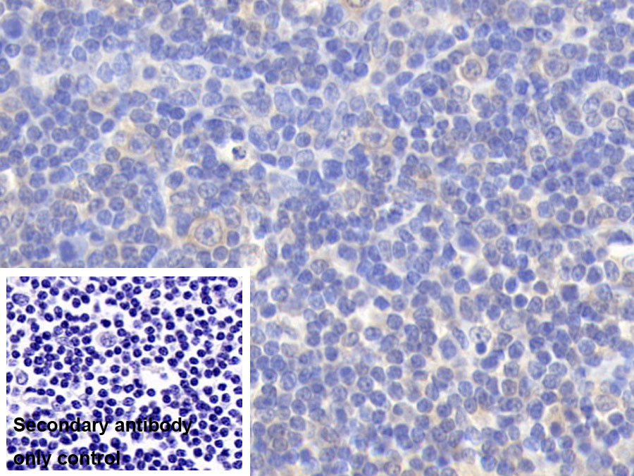 DAB staining on IHC-P; Sample: Porcine Kidney Tissue; Primary Ab: 20ug/ml Mouse Anti-Human IL12B Antibody; Control: Used PBS instead of primary antibody; Second Ab: 2ug/ml HRP-Linked Caprine Anti-Mouse IgG Polyclonal Antibody