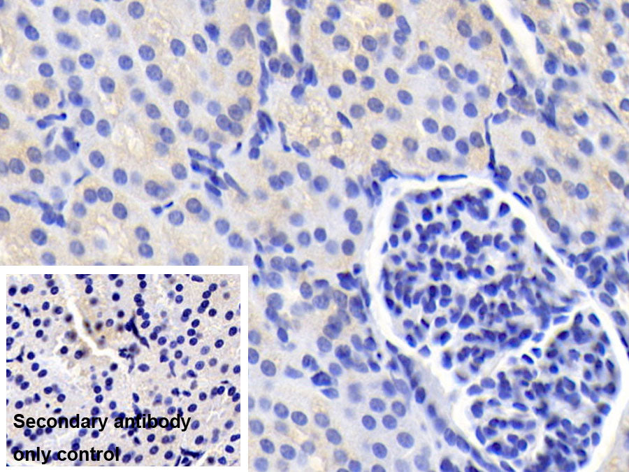 DAB staining on IHC-P; Sample: Porcine Stomach Tissue; Primary Ab: 20ug/ml Mouse Anti-Human IL12B Antibody; Control: Used PBS instead of primary antibody; Second Ab: 2ug/ml HRP-Linked Caprine Anti-Mouse IgG Polyclonal Antibody