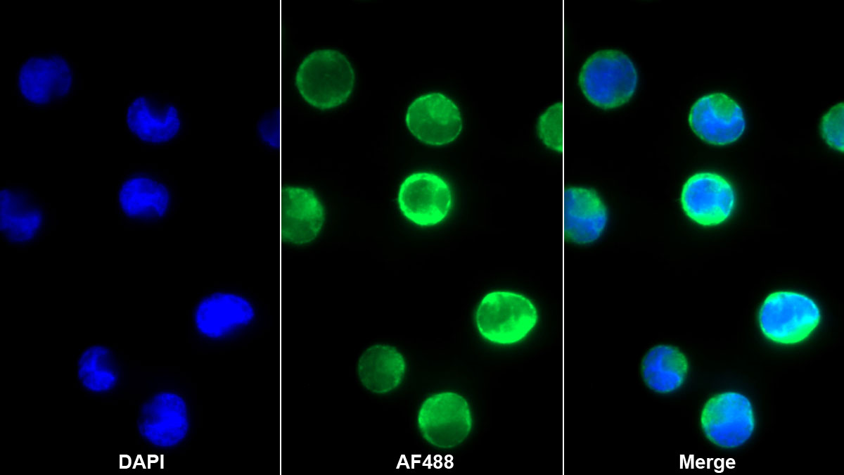 Interleukin 12B (IL12B) Monoclonal Antibody - image 5