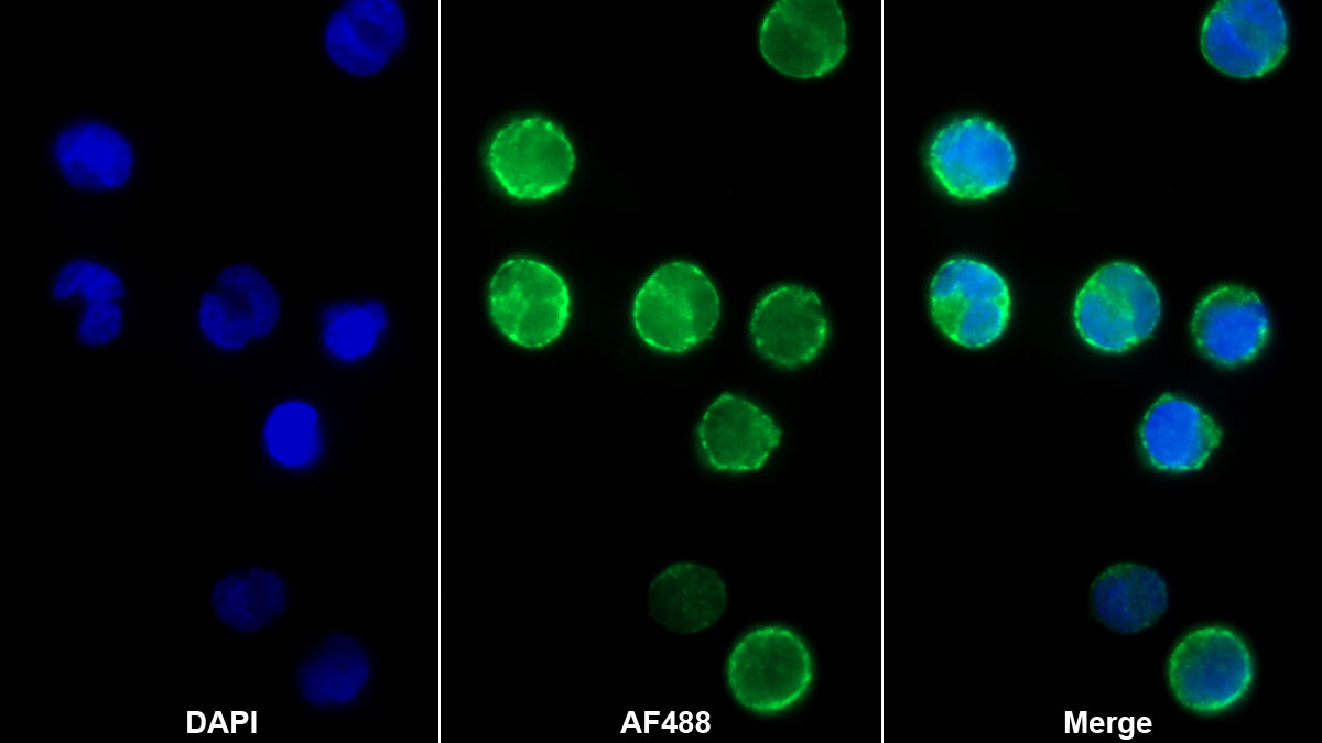 Interleukin 12B (IL12B) Monoclonal Antibody - image 3