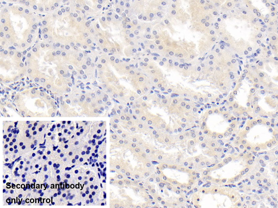 DAB staining on IHC-P; Sample: Porcine Spleen Tissue; Primary Ab: 20ug/ml Mouse Anti-Human IL18 Antibody; Control: Used PBS instead of primary antibody; Second Ab: 2ug/ml HRP-Linked Caprine Anti-Mouse IgG Polyclonal Antibody
