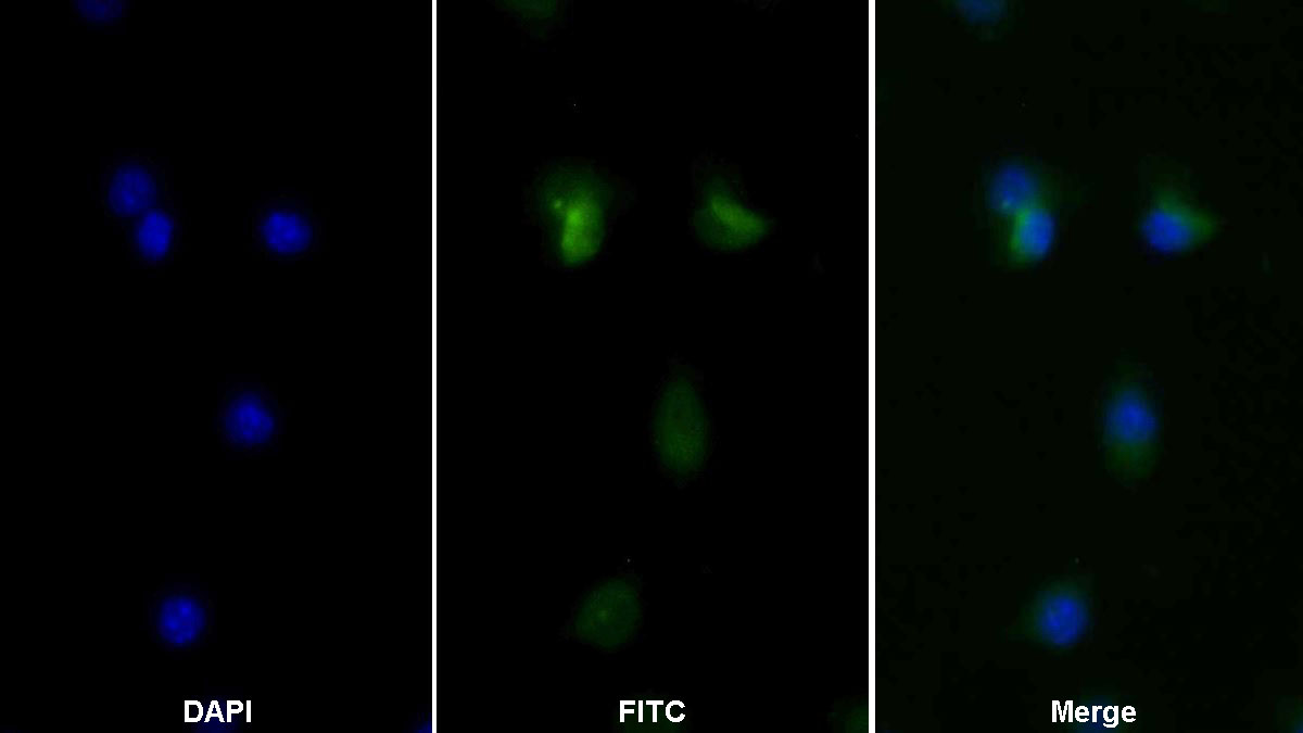 Tumor Necrosis Factor Alpha (TNFa) Monoclonal Antibody - image 2