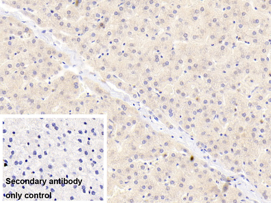 DAB staining on IHC-P; Sample: Porcine Kidney Tissue; Primary Ab: 20ug/ml Mouse Anti-Human a2PI Antibody; Control: Used PBS instead of primary antibody; Second Ab: 2ug/ml HRP-Linked Caprine Anti-Mouse IgG Polyclonal Antibody