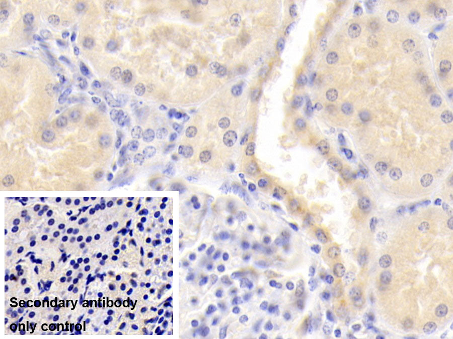 Alpha 2-Antiplasmin (a2PI) Monoclonal Antibody - image 3