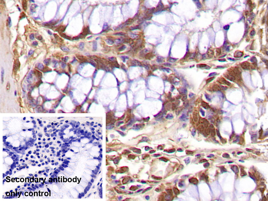 DAB staining on IHC-P; Sample: Porcine Cerebrum Tissue; Primary Ab: 40ug/ml Mouse Anti-Multi-species Ub Antibody; Control: Used PBS instead of primary antibody; Second Ab: 2ug/ml HRP-Linked Caprine Anti-Mouse IgG Polyclonal Antibody