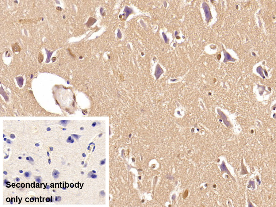 DAB staining on IHC-P; Sample: Porcine Small intestine Tissue; Primary Ab: 40ug/ml Mouse Anti-Multi-species Ub Antibody; Control: Used PBS instead of primary antibody; Second Ab: 2ug/ml HRP-Linked Caprine Anti-Mouse IgG Polyclonal Antibody