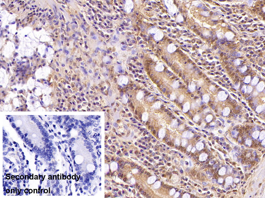 DAB staining on IHC-P; Sample: Porcine Pancreas Tissue; Primary Ab: 40ug/ml Mouse Anti-Multi-species Ub Antibody; Control: Used PBS instead of primary antibody; Second Ab: 2ug/ml HRP-Linked Caprine Anti-Mouse IgG Polyclonal Antibody