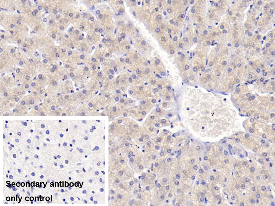 Alanine Aminotransferase (ALT) Monoclonal Antibody - image 2