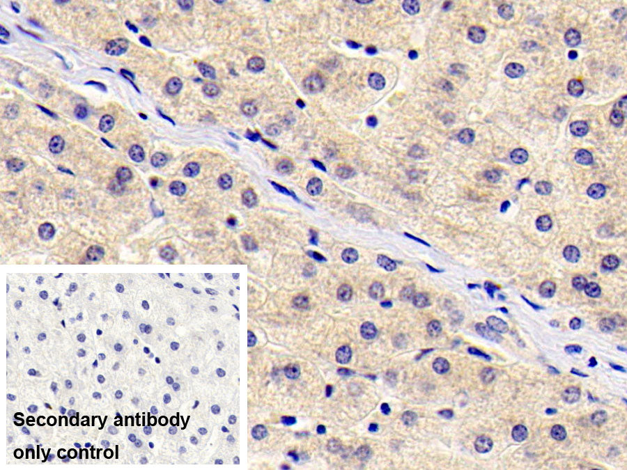 Thymic Stromal Lymphopoietin (TSLP) Monoclonal Antibody - image 2