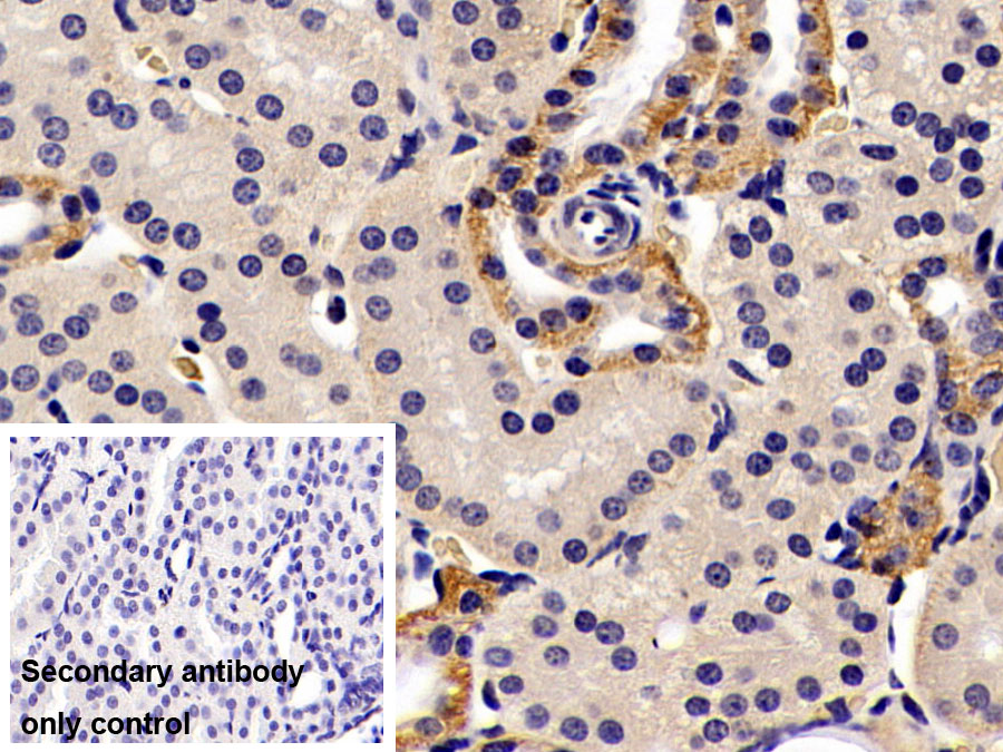Alanine Aminotransferase (ALT) Monoclonal Antibody - image 2
