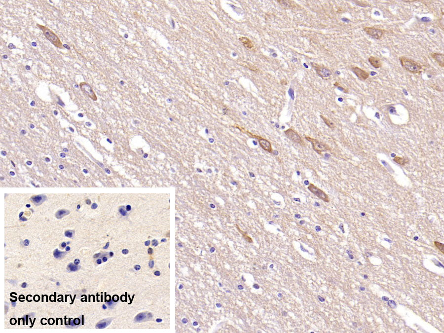 DAB staining on IHC-P; Sample: Porcine Kidney Tissue; Primary Ab: 40ug/ml Mouse Anti-Human NRGN Antibody; Control: Used PBS instead of primary antibody; Second Ab: 2ug/ml HRP-Linked Caprine Anti-Mouse IgG Polyclonal Antibody