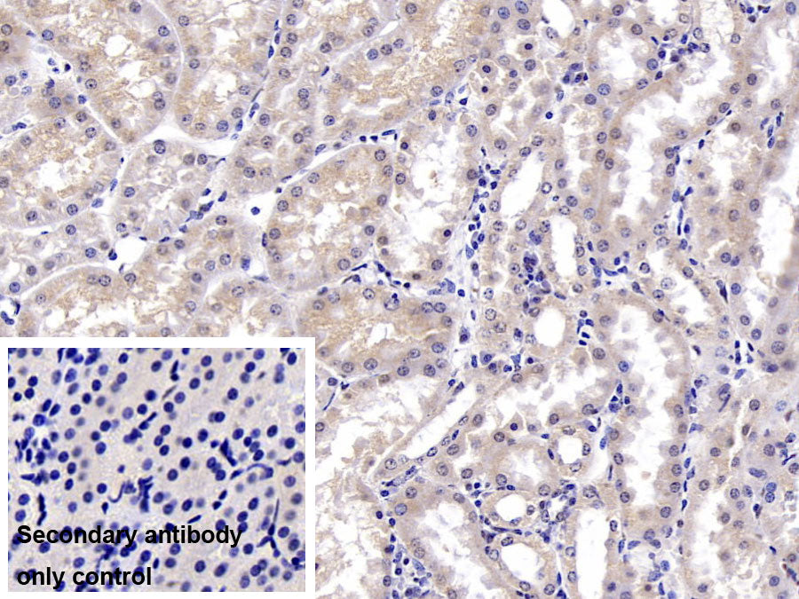 DAB staining on IHC-P; Sample: Mouse Kidney Tissue; Primary Ab: 20ug/ml Mouse Anti-Mouse DTYMK Antibody; Control: Used PBS instead of primary antibody; Second Ab: 2ug/ml HRP-Linked Caprine Anti-Mouse IgG Polyclonal Antibody