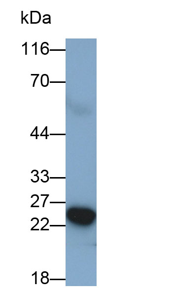 Human U2OS cell line was fixed with 2% paraformaldehyde