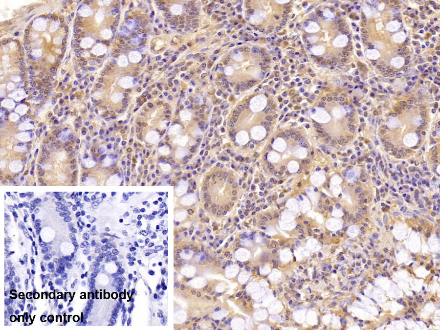 DAB staining on IHC-P; Sample: Porcine Kidney Tissue; Primary Ab: 40ug/ml Mouse Anti-Human ASPH Antibody; Control: Used PBS instead of primary antibody; Second Ab: 2ug/ml HRP-Linked Caprine Anti-Mouse IgG Polyclonal Antibody