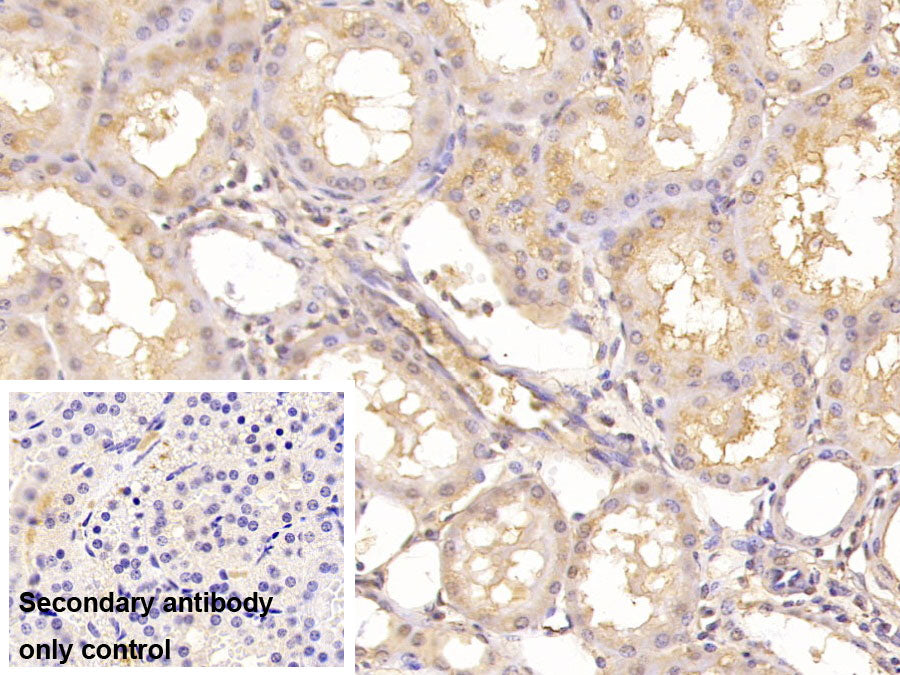 DAB staining on IHC-P; Sample: Porcine Pancreas Tissue; Primary Ab: 40ug/ml Mouse Anti-Human ASPH Antibody; Control: Used PBS instead of primary antibody; Second Ab: 2ug/ml HRP-Linked Caprine Anti-Mouse IgG Polyclonal Antibody