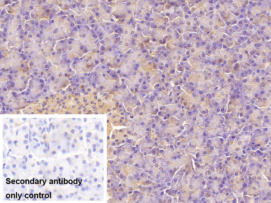 Aspartate Beta Hydroxylase (ASPH) Monoclonal Antibody - image 4