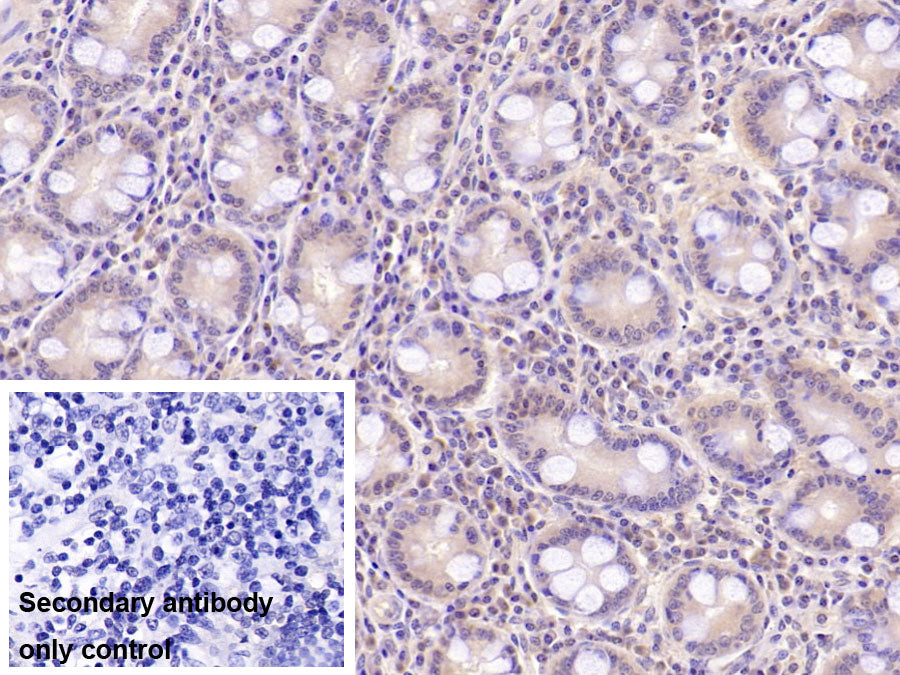 DAB staining on IHC-P; Sample: Porcine Kidney Tissue; Primary Ab: 40ug/ml Mouse Anti-Human ASPH Antibody; Control: Used PBS instead of primary antibody; Second Ab: 2ug/ml HRP-Linked Caprine Anti-Mouse IgG Polyclonal Antibody