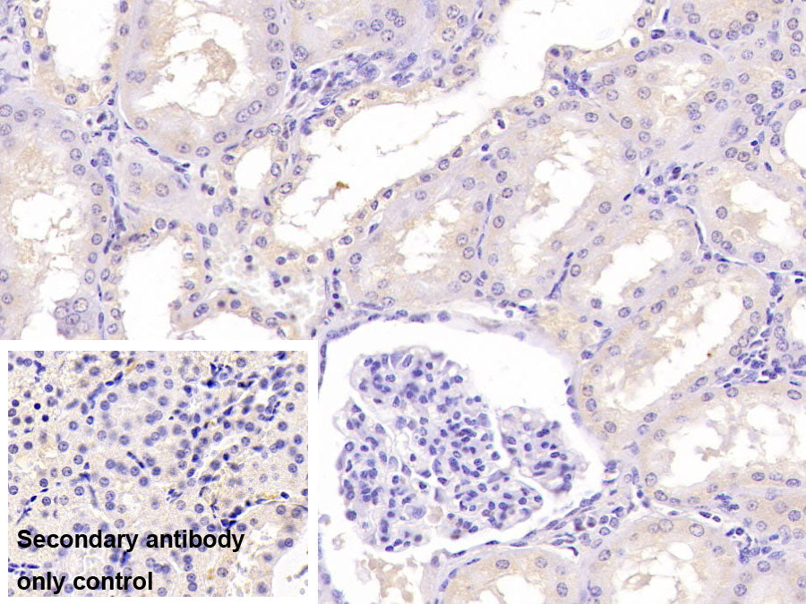 DAB staining on IHC-P; Sample: Porcine Pancreas Tissue; Primary Ab: 40ug/ml Mouse Anti-Human ASPH Antibody; Control: Used PBS instead of primary antibody; Second Ab: 2ug/ml HRP-Linked Caprine Anti-Mouse IgG Polyclonal Antibody