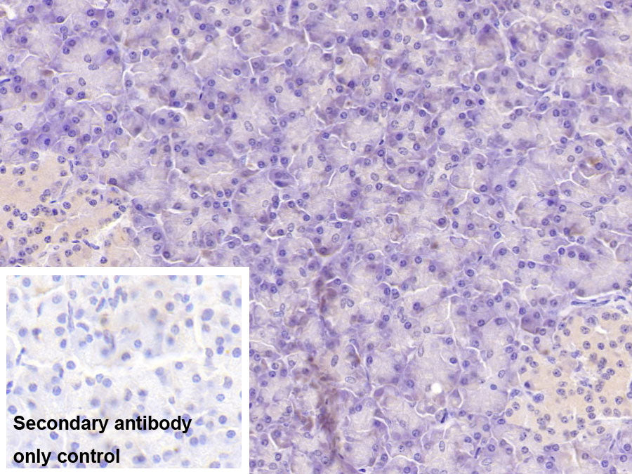 Aspartate Beta Hydroxylase (ASPH) Monoclonal Antibody - image 4