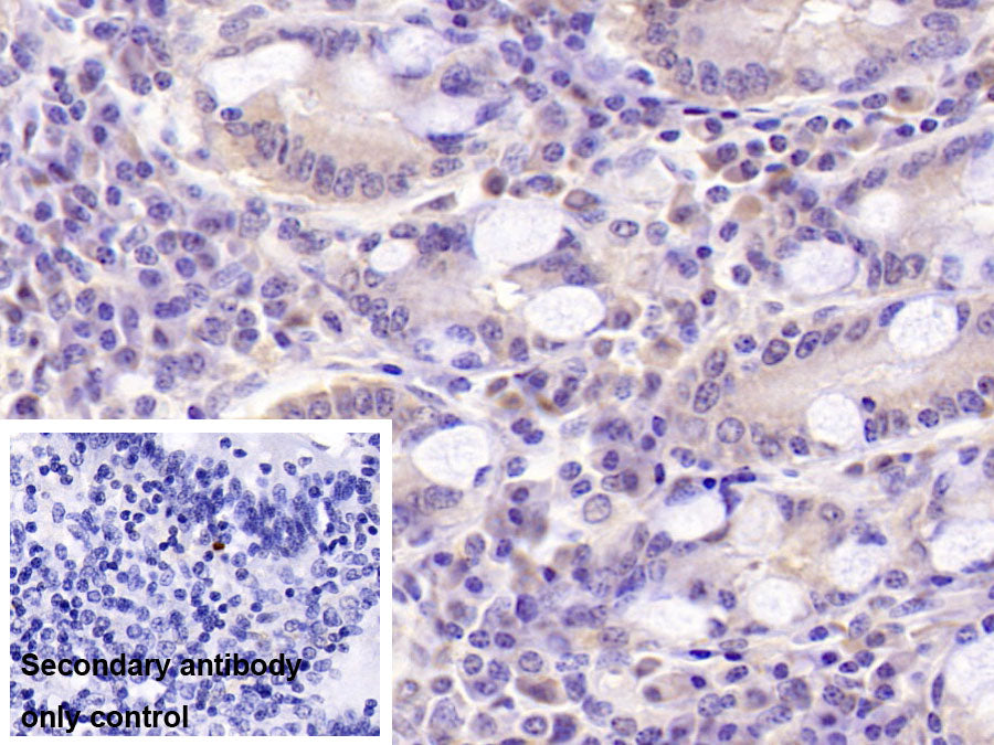 Dynein, Axonemal, Heavy Chain 11 (DNAH11) Monoclonal Antibody - image 2