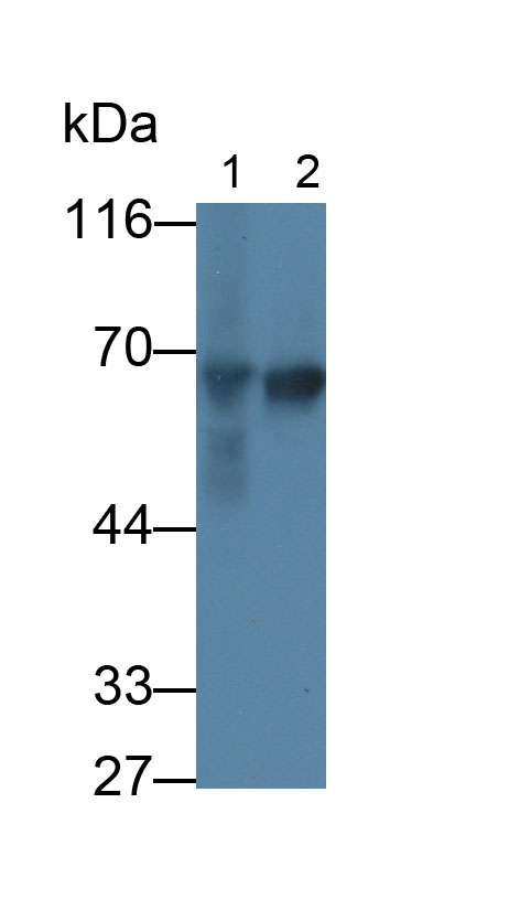 Alpha-Fetoprotein (AFP) Monoclonal Antibody - image 2