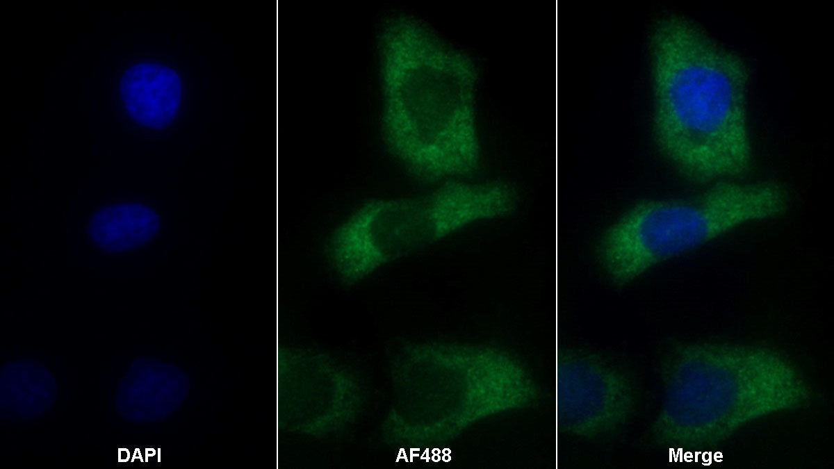 Procollagen III N-Terminal Propeptide (PIIINP) Monoclonal Antibody - image 2