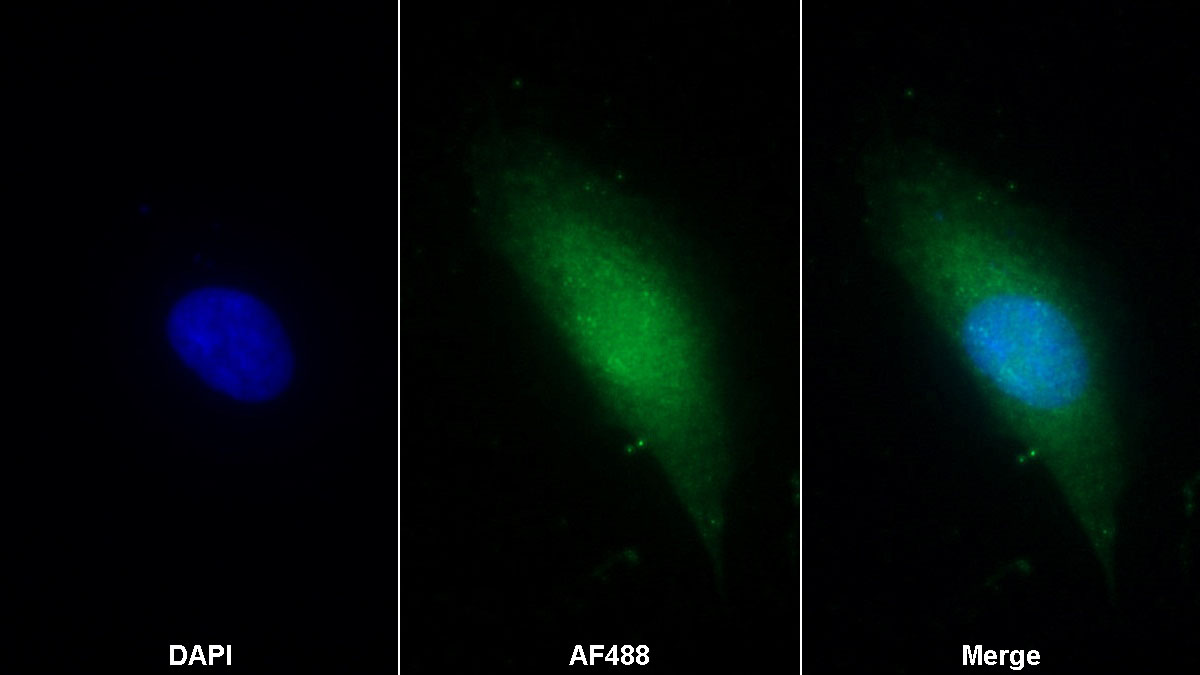 Western Blot; Sample: Lane1: Porcine Esophagus; Lane2: Porcine Stomach lysate; Lane3: Porcine Skin lysate; Lane4: A431 cell lysate Primary Ab: 0.2ug/ml Mouse Anti-Human S100A2 Antibody Second Ab: 0.2ug/mL HRP-Linked Caprine Anti-Mouse IgG Polyclonal Antibody