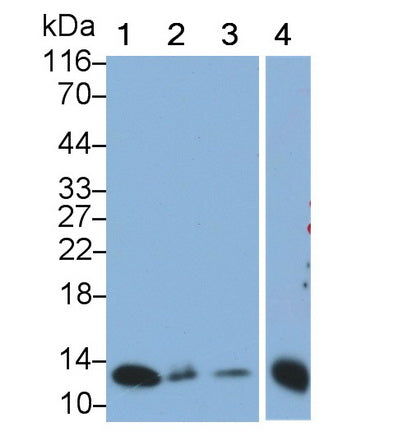 S100 Calcium Binding Protein A2 (S100A2) Monoclonal Antibody - image 3