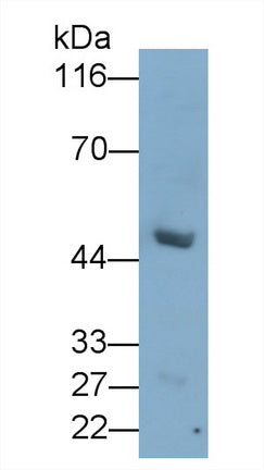 Anthrax Toxin Receptor 2 (ANTXR2) Monoclonal Antibody - image 2